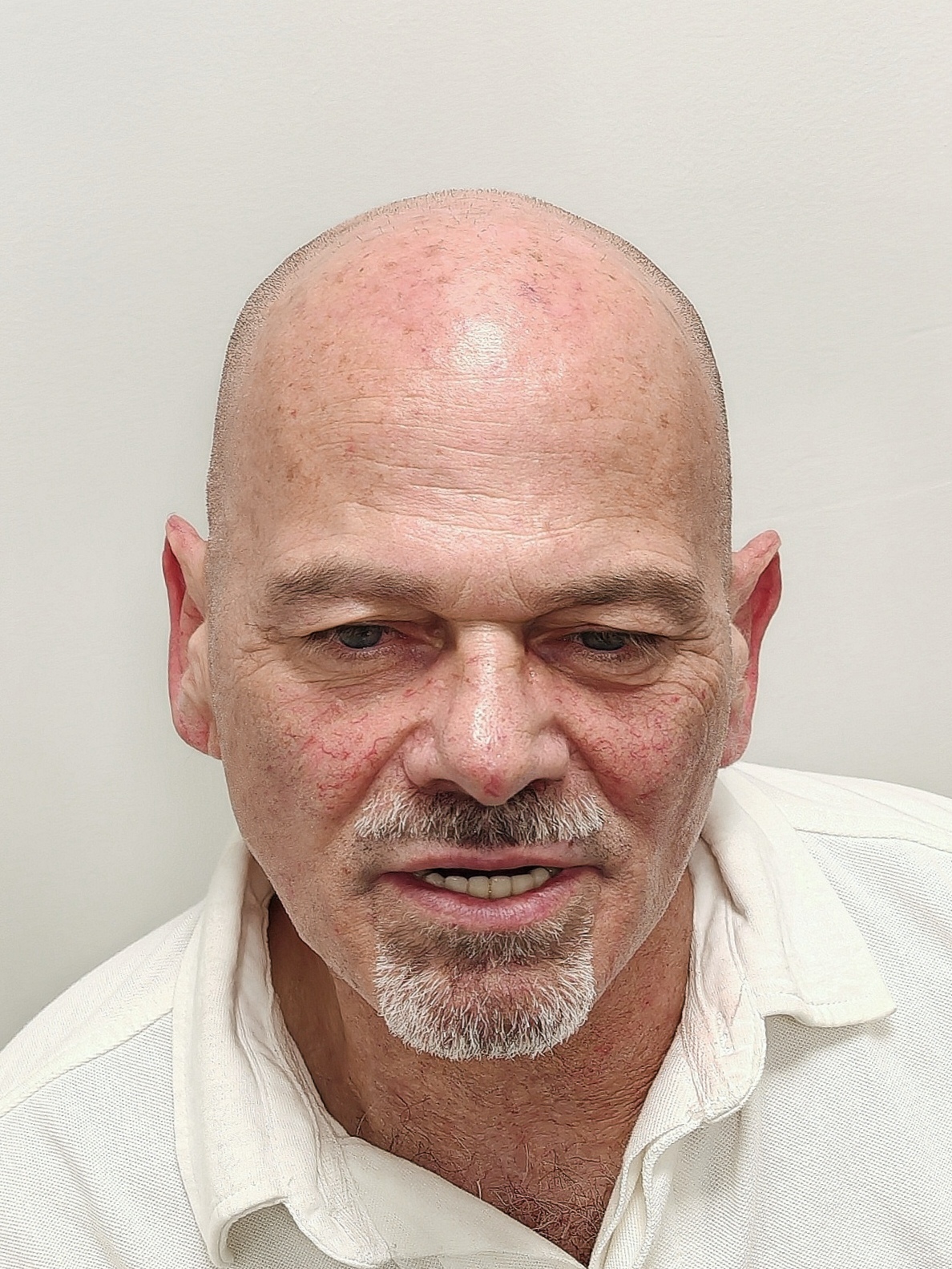 Antes frontal Antes frontal