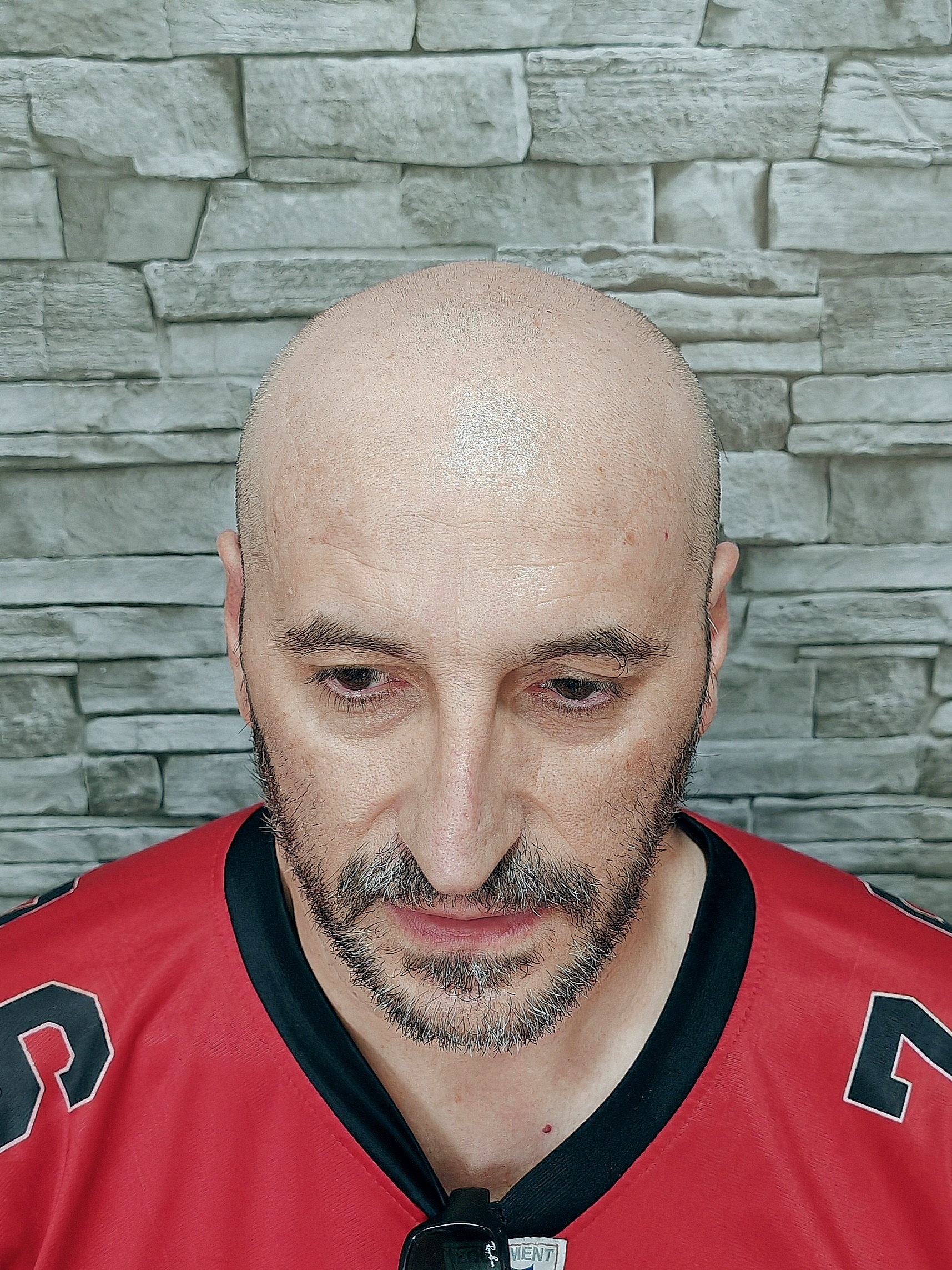 Antes_frontal Antes_frontal