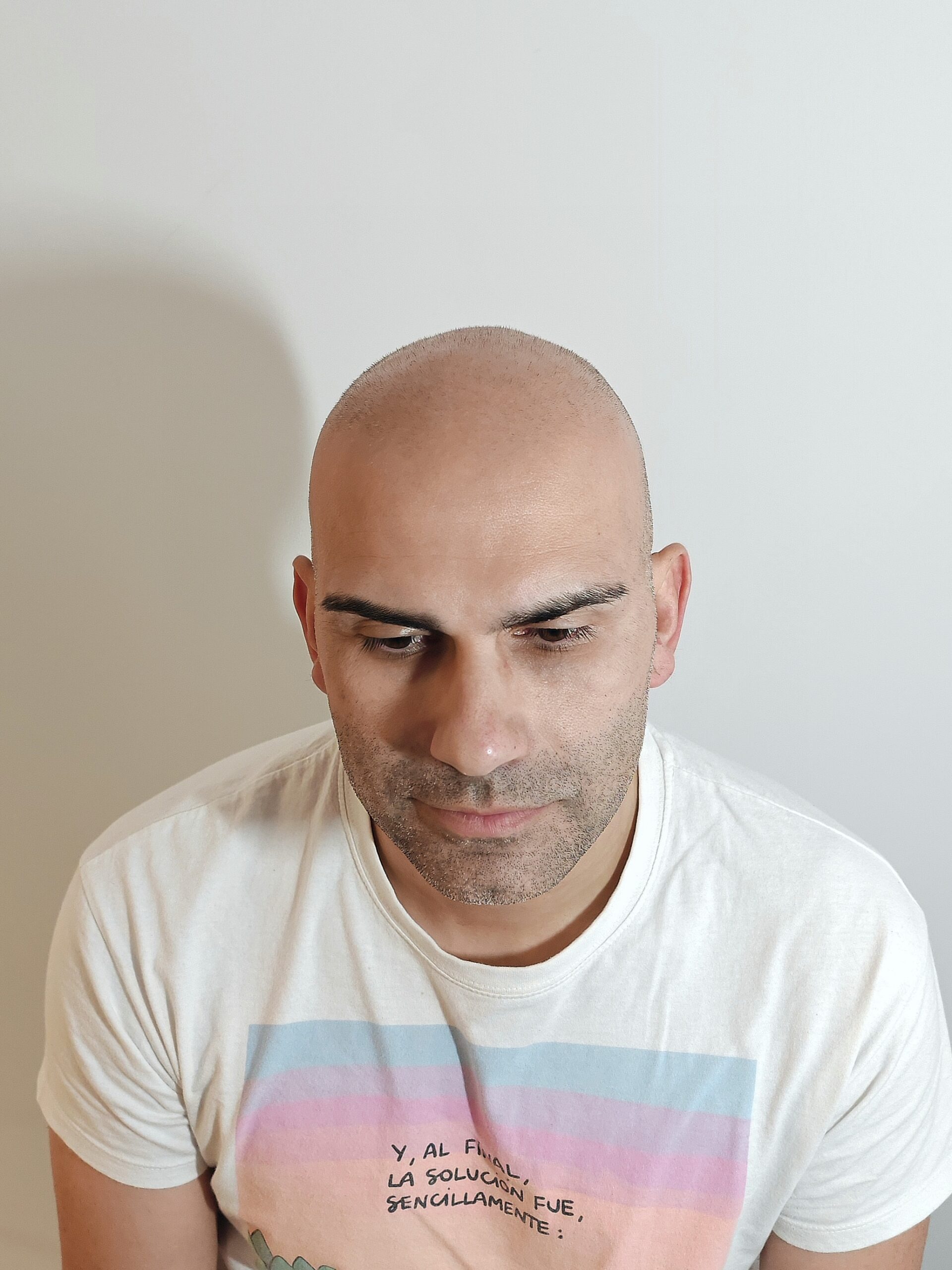 Antes_frontal1 (1) Antes_frontal1 (1)