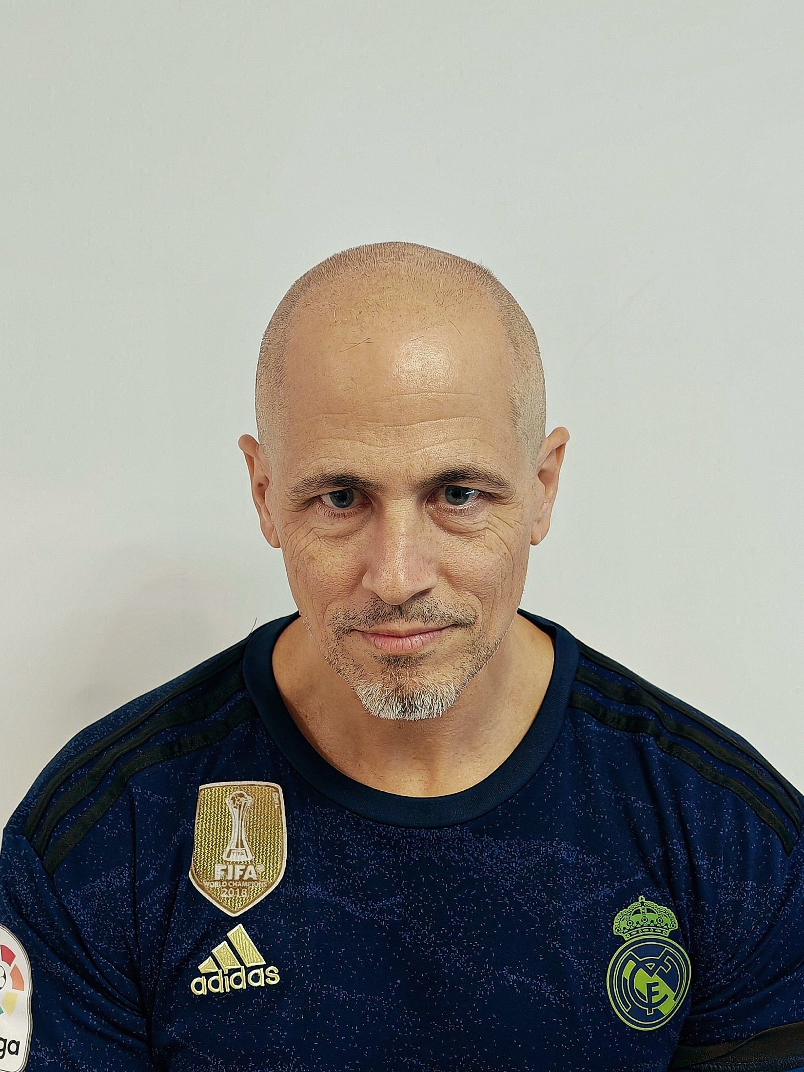 Antes_frontal1 Antes_frontal1