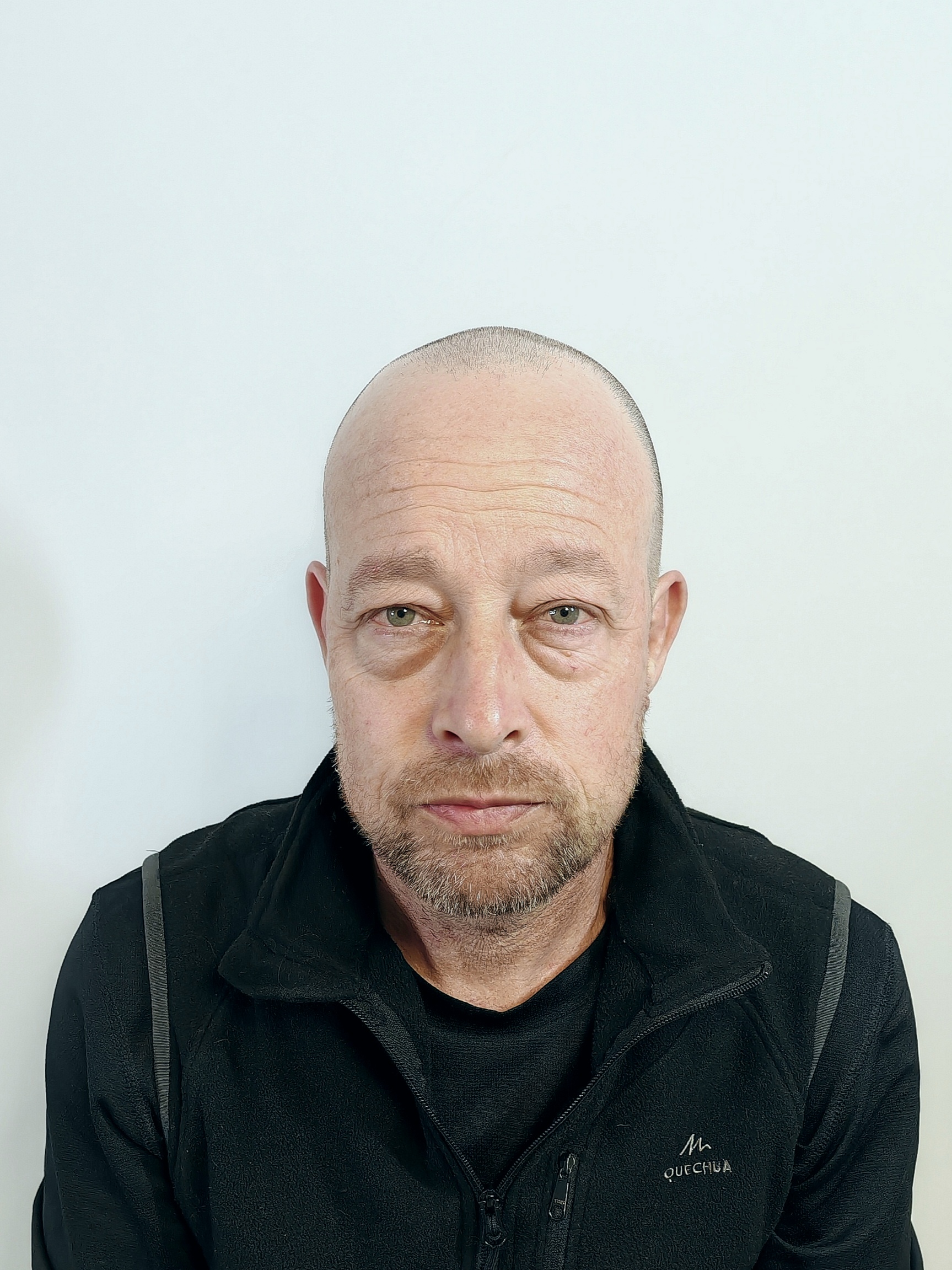 Antes_frontal2 Antes_frontal2