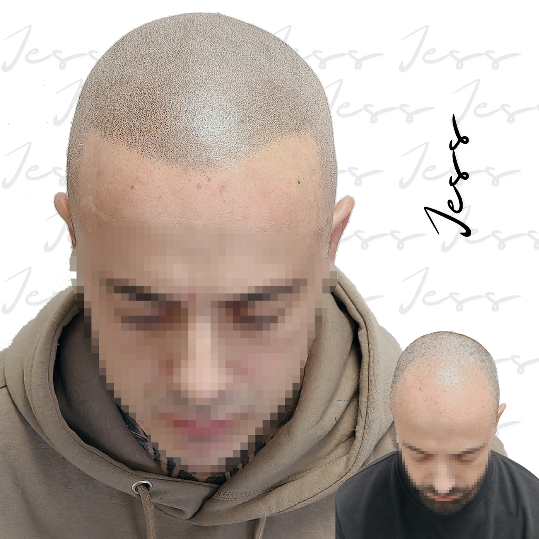 Carrusel+1+-+3-1920w