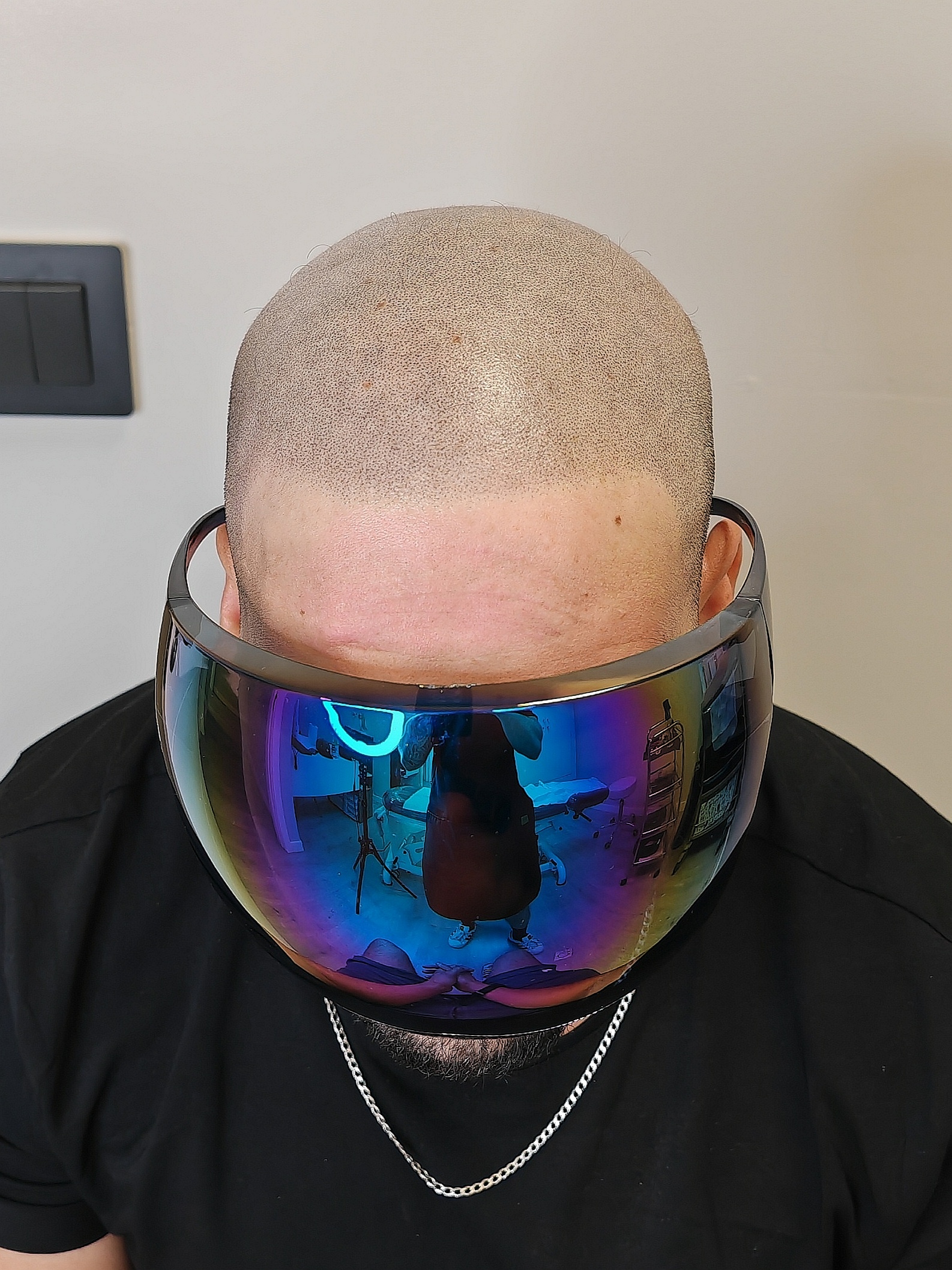 Después frontal (1)