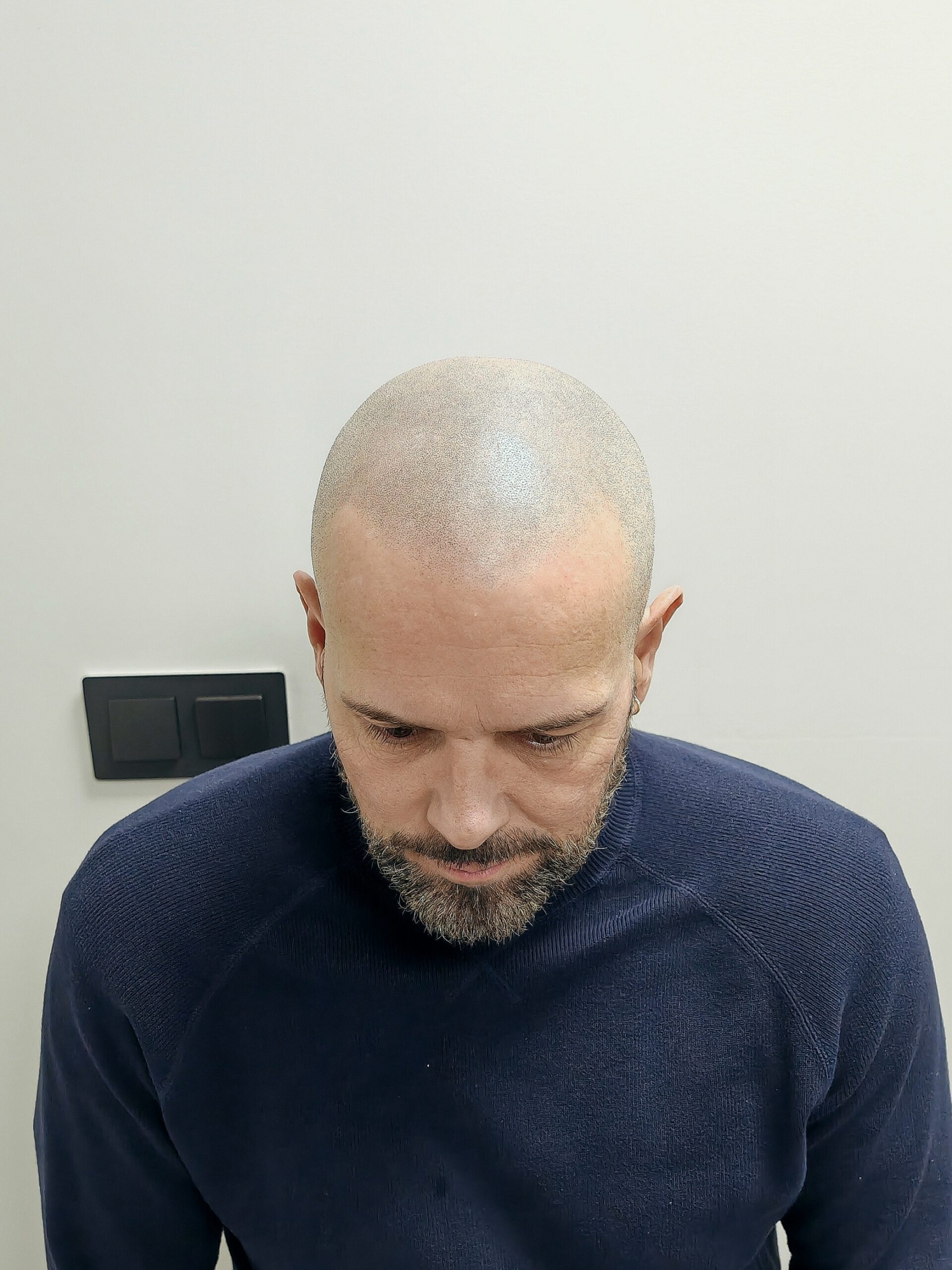 Después_frontal (1)