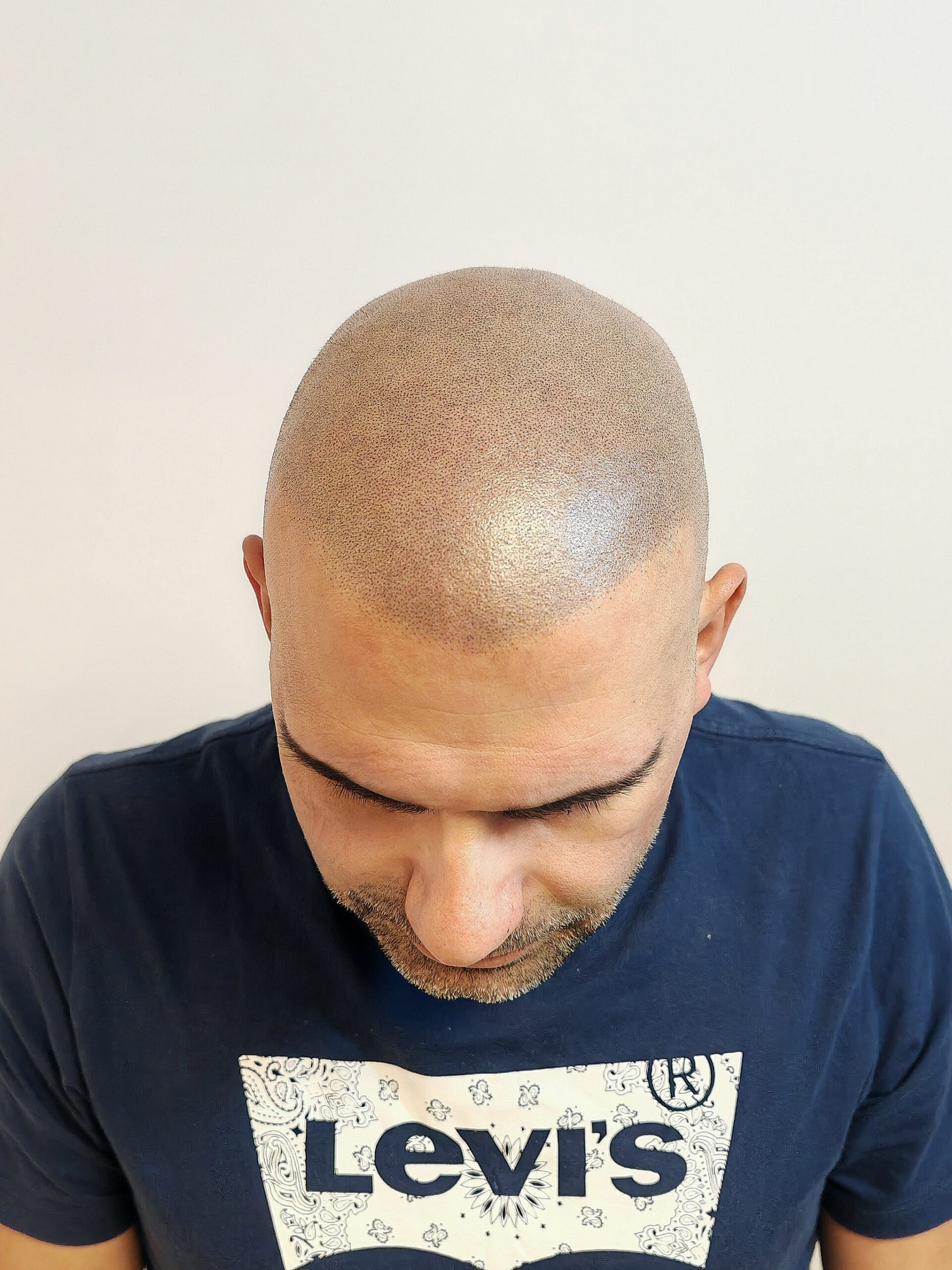 Después_frontal1 (1)